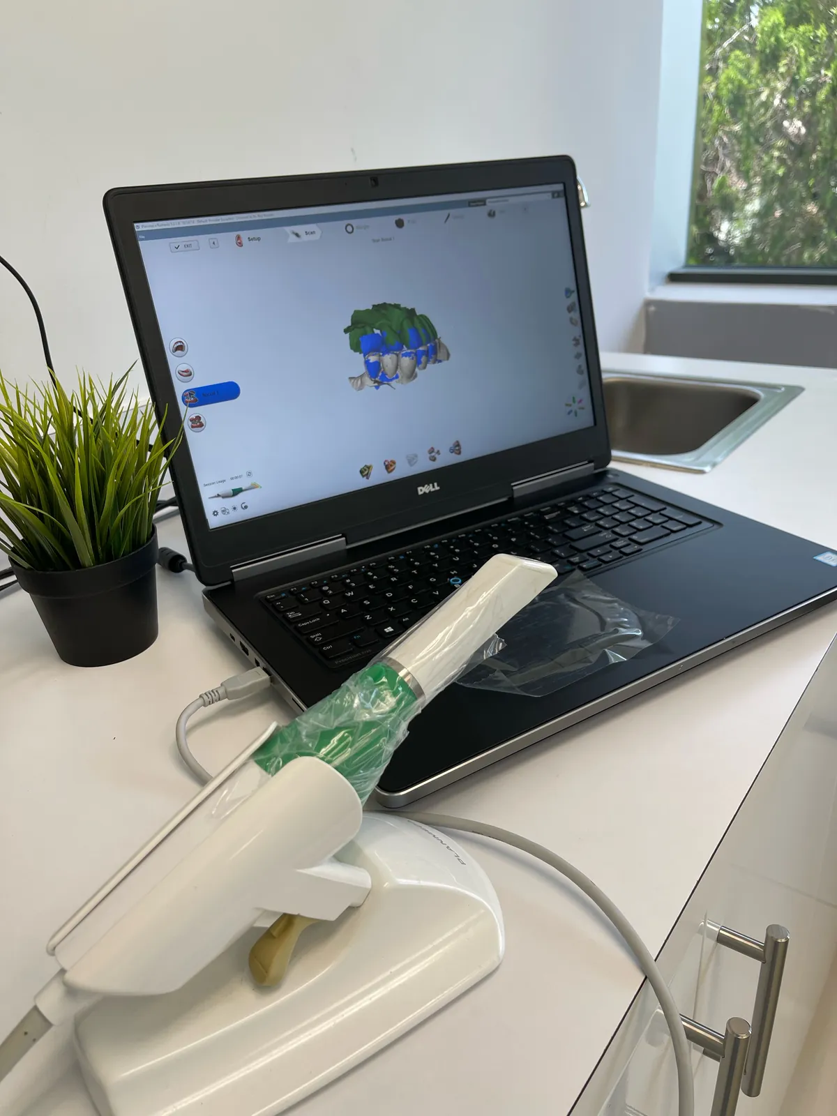 Intraoral scanner workstation in the Rosado Dental clinic